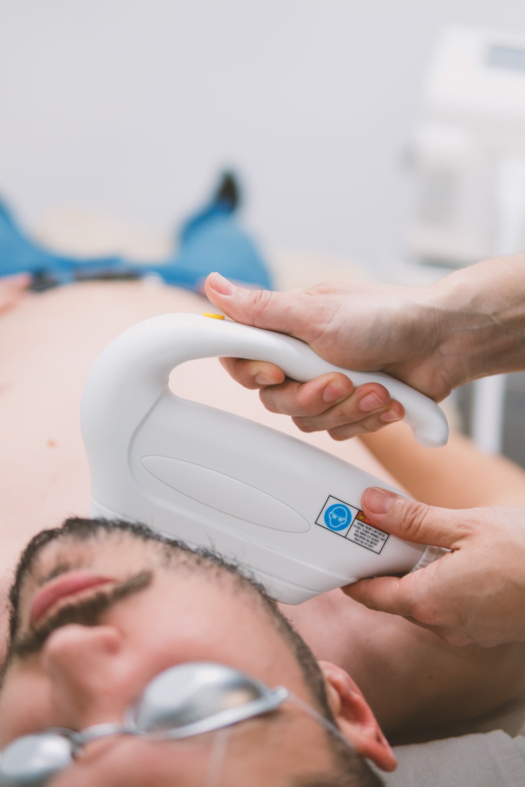 Depilación facial SHR